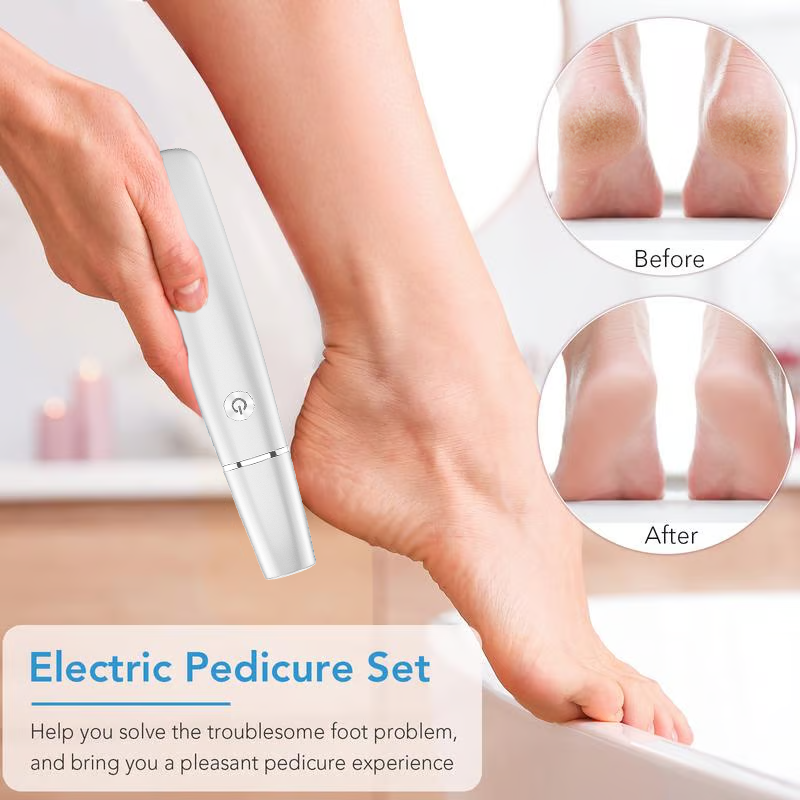 Vermoila | Electric feet callus remover
