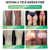 𝐒𝐓𝐃𝐄𝐈® 𝐆𝐋𝐏-𝟏 𝐖𝐞𝐢𝐠𝐡𝐭 𝐋𝐨𝐬𝐬 𝐎𝐫𝐚𝐥 𝐒𝐨𝐥𝐮𝐭𝐢𝐨𝐧