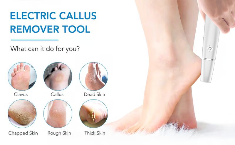 Vermoila | Electric feet callus remover