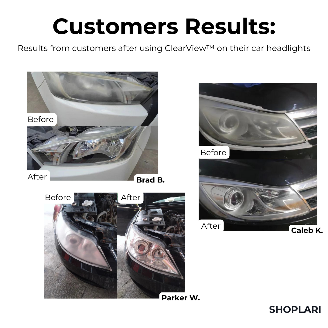 ClearView™ Headlight Repair Fluid I Last Day 1+1 FREE