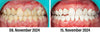 VitalMouth Clove Mouth Spray - Natural Care for Healthy Gums & Fresh Breath