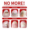 Nail treatment – Natural antifungal care