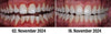 VitalMouth Clove Mouth Spray - Natural Care for Healthy Gums & Fresh Breath