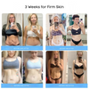 Liftora™ Tighten and Firm Your Skin Without Surgery