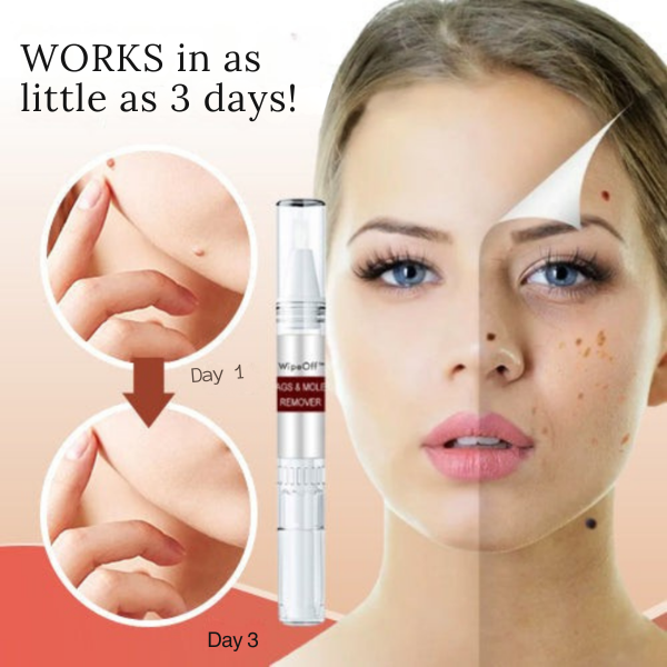 Wipe-off Mole and Stain Remover