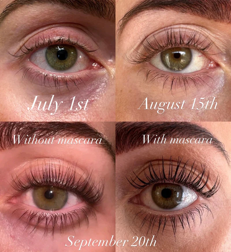 BUY 1 GET 1 FREE | Kaylash Growth Serum | Serum Effectiive Eyelash Solution