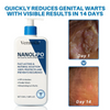 Vermoila® NanoLipo HPV Genital Warts Waser Cream