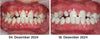 VitalMouth Clove Mouth Spray - Natural Care for Healthy Gums & Fresh Breath