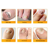 1+1 FREE | Nailox™ – Fast & Discreet Nail Fungus Treatment