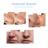 5 + 5 FREE | ViyaClean™ Pore Cleansing Serum