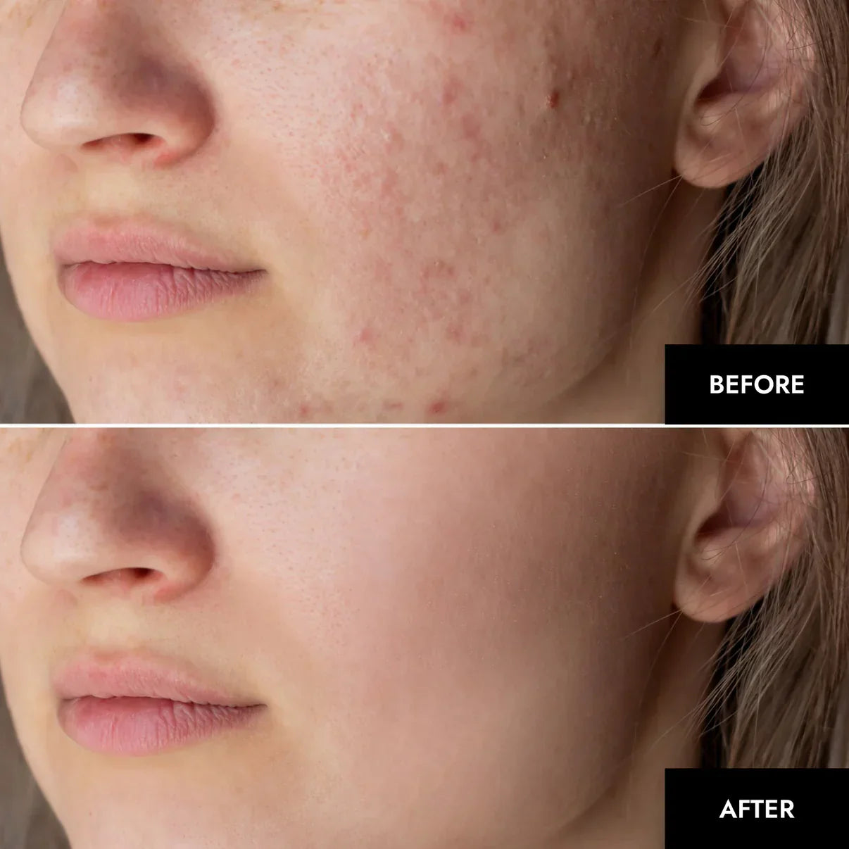 NatuGlow™ – The Ultimate Solution for Instantly Smoother, Brighter Skin