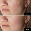 NatuGlow™ – The Ultimate Solution for Instantly Smoother, Brighter Skin