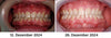 VitalMouth Clove Mouth Spray - Natural Care for Healthy Gums & Fresh Breath