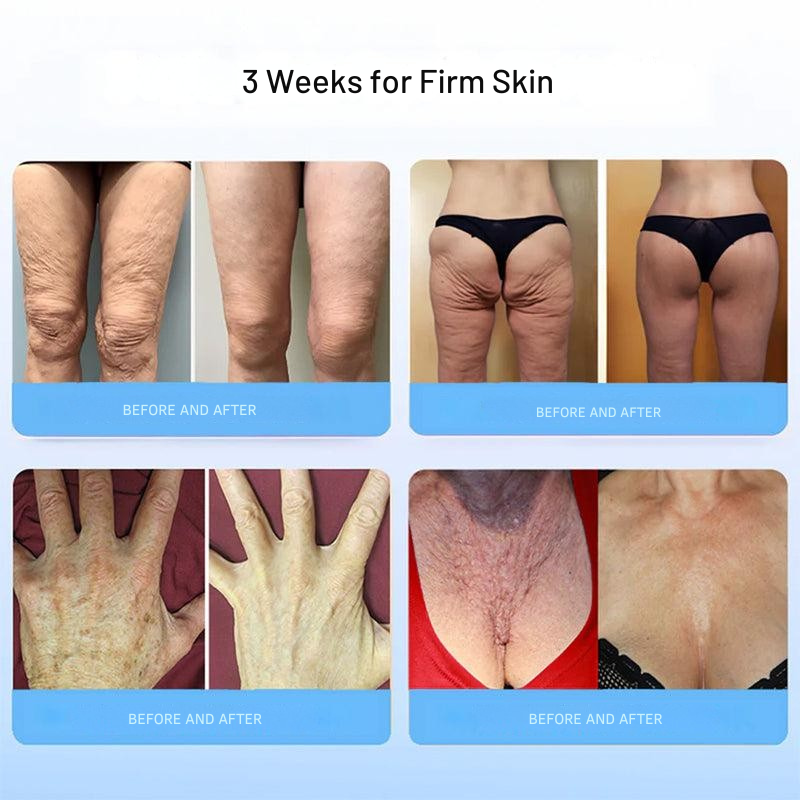 Liftora™ Tighten and Firm Your Skin Without Surgery