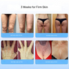 Liftora™ Tighten and Firm Your Skin Without Surgery