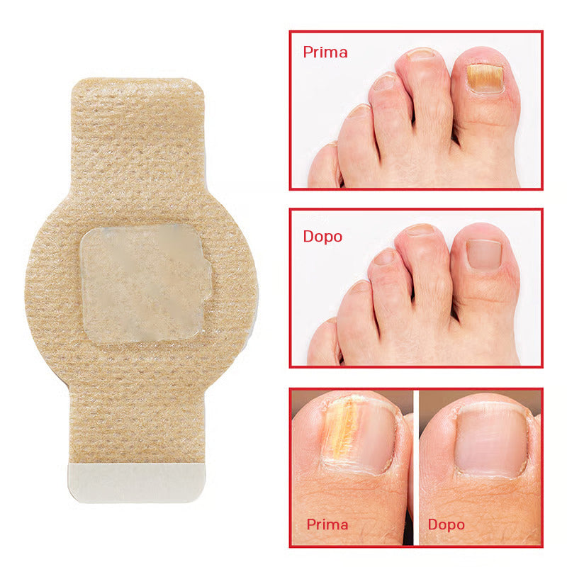 FungiShield™ Pro Nail Repair Patches