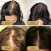 FolliPrime Synergy Oil - Achieve Visibly Thicker, Fuller Hair and Renewed Confidence
