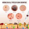 Wipe-off Mole and Stain Remover