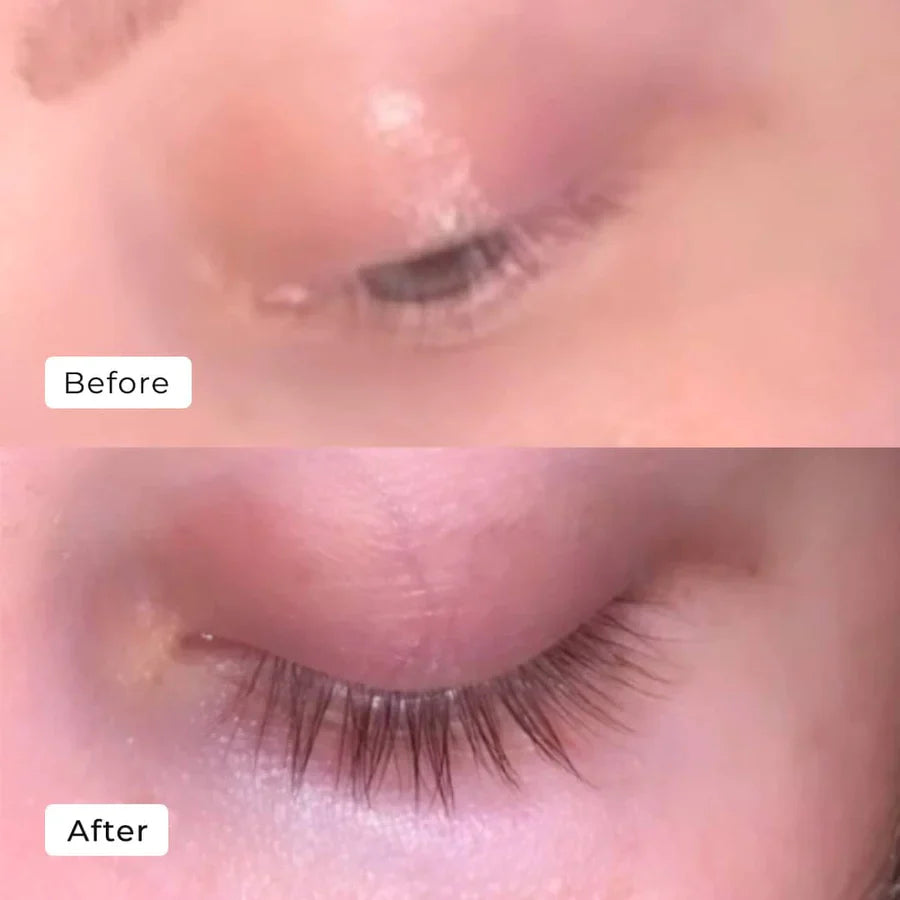 BUY 1 GET 1 FREE | Kaylash Growth Serum | Serum Effectiive Eyelash Solution