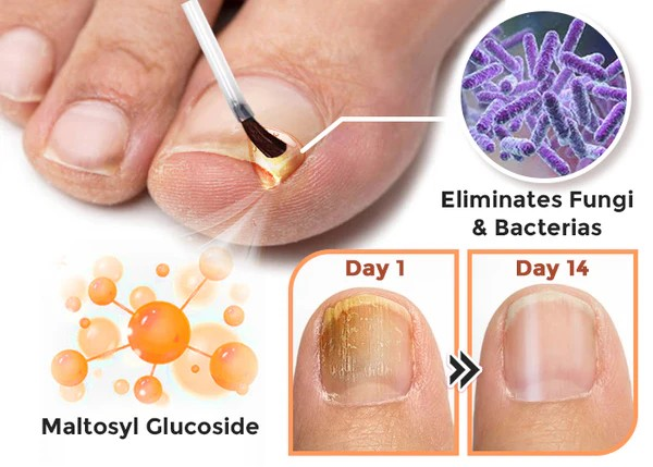 NailVita - 7 Days Nail Growth & Strengthening Serum