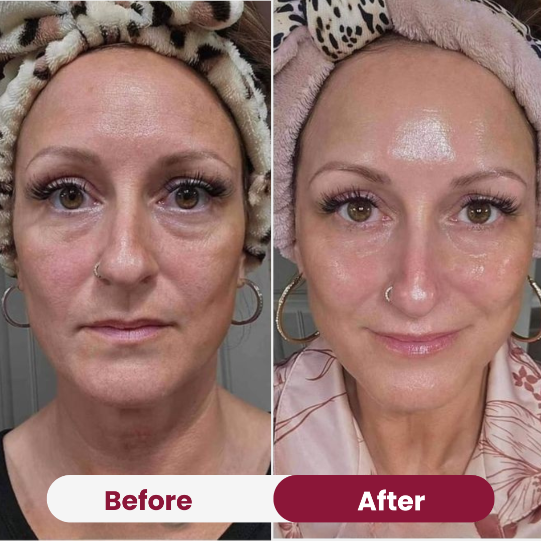 Bio-Collagen Mask