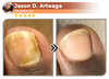NailVita - 7 Days Nail Growth & Strengthening Serum