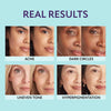 SupremeCrème – Hydrating Concealer with Natural Coverage Finish