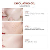 DermaClear™ | Radiant Clear Skin Exfoliating Gel
