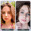 EyeCatcher™ | Change the Color of Your Eyes, Naturally