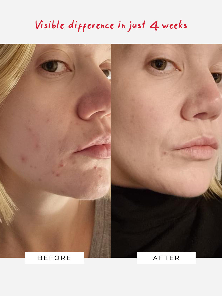 Flawless Neutralising Gel