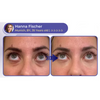 DermaBee Collagen+ Bee Venom Eye Cream Roll-on - Dermatologically Approved