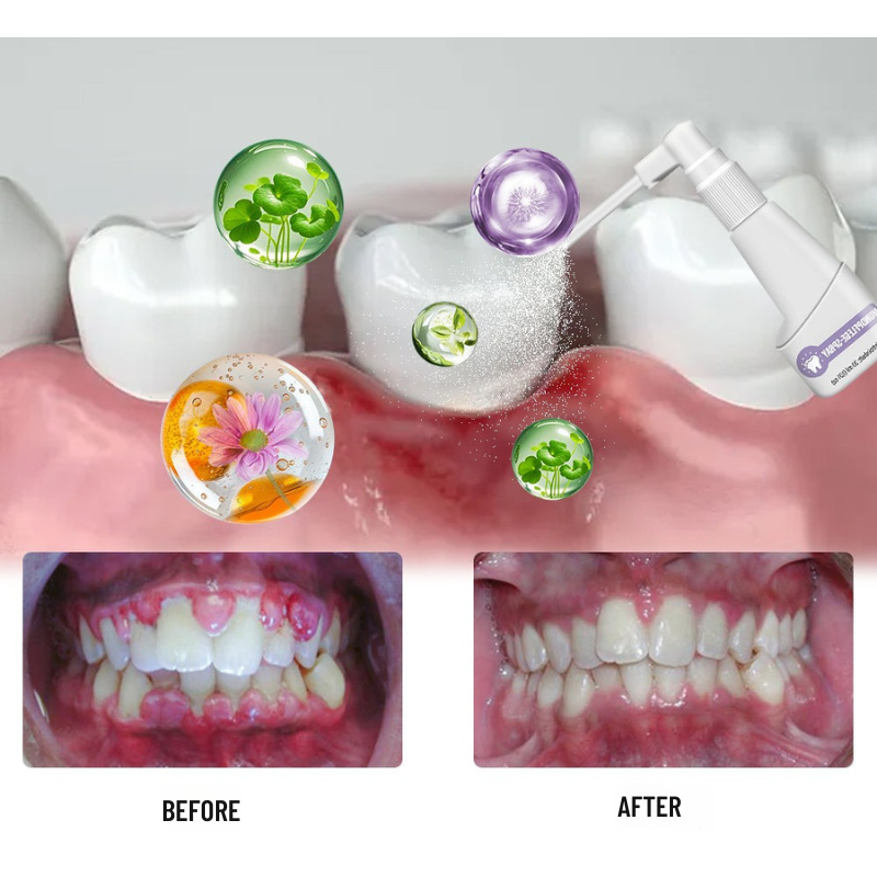 VitalMouth Clove Mouth Spray - Natural Care for Healthy Gums & Fresh Breath