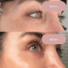 Ephylift - Silicone anti-wrinkle patches that regenerate and plump your skin