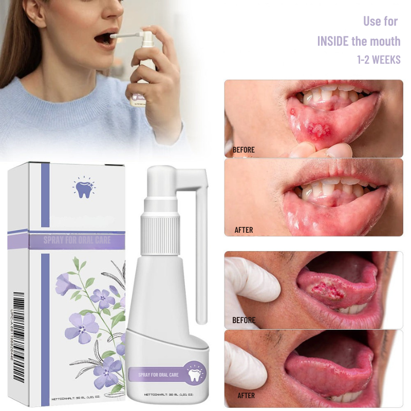 VitalMouth Clove Mouth Spray - Natural Care for Healthy Gums & Fresh Breath