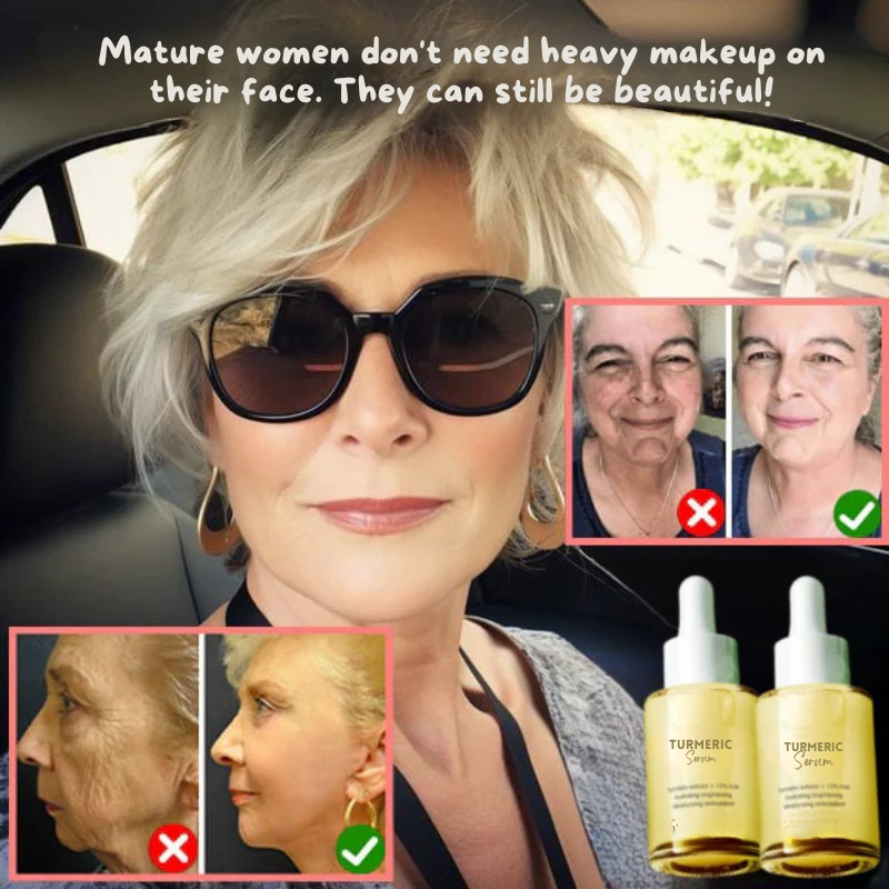 GlowLait Turmeric Milk Facial Serum - Antioxidant Serum with Hyaluronic Acid, Niacinamide and Milk Extract - Anti-Aging & Skin Brightening with Curcuma Longa - 30 ml 1 + 1 FREE