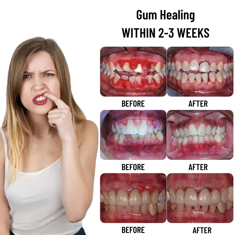 VitalMouth Clove Mouth Spray - Natural Care for Healthy Gums & Fresh Breath
