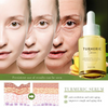 GlowLait Turmeric Milk Facial Serum - Antioxidant Serum with Hyaluronic Acid, Niacinamide and Milk Extract - Anti-Aging & Skin Brightening with Curcuma Longa - 30 ml 1 + 1 FREE