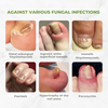 NectarNail Bee Poison Nail Repair Oil | Eliminates Fungus, Restores and Strengthens Nails