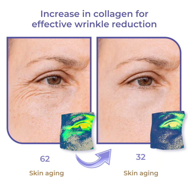 DermaBee Collagen+ Bee Venom Eye Cream Roll-on - Dermatologically Approved