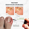 NectarNail Bee Poison Nail Repair Oil | Eliminates Fungus, Restores and Strengthens Nails