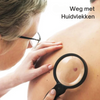 Crème voor Directe Verwijdering van Onzuiverheden op de Huid