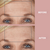 Ephylift - Silicone anti-wrinkle patches that regenerate and plump your skin