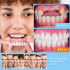 OrthoFlex - Custom Full Dentures | Natural Fit, Comfort & Self Confidence