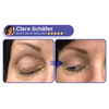 DermaBee Collagen+ Bee Venom Eye Cream Roll-on - Dermatologically Approved