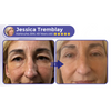 DermaBee Collagen+ Bee Venom Eye Cream Roll-on - Dermatologically Approved