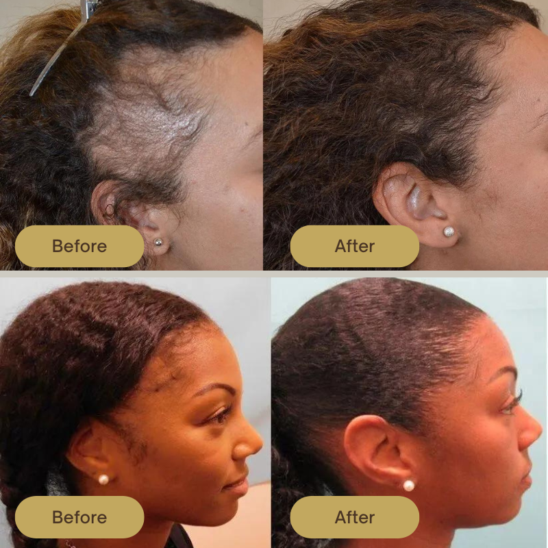 FolliPrime Synergy Oil - Achieve Visibly Thicker, Fuller Hair and Renewed Confidence