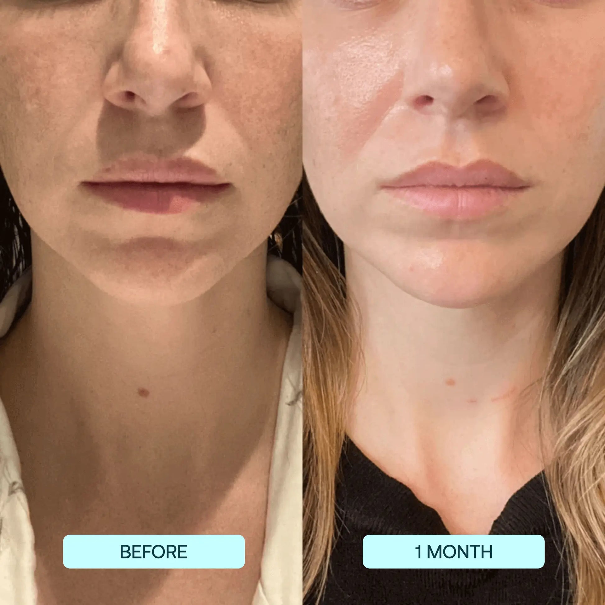NatuGlow™ – The Ultimate Solution for Instantly Smoother, Brighter Skin