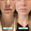 NatuGlow™ – The Ultimate Solution for Instantly Smoother, Brighter Skin