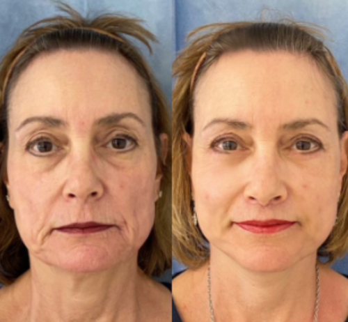 NatuGlow™ – The Ultimate Solution for Instantly Smoother, Brighter Skin