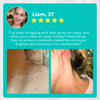 Fivfivgo™ NatureErase Instant Mole & Spot Cream